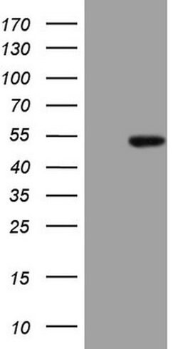 ATP6V1C2 Mouse anti-Human, Clone: OTI3E9, lyophilized, TrueMAB 100 &mu;g;