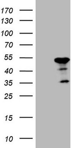 ATP6V1C2 Monoclonal Antibody (OTI8H4), TrueMAB , OriGene 100 &mu;L; Unconjugated:Antibodies,
