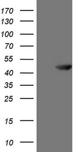 ATP6V1C2 Monoclonal Antibody (OTI5C4), TrueMAB , OriGene:Antibodies:Primary