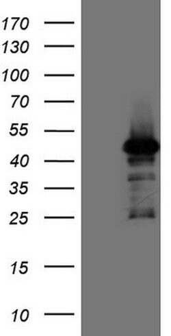 ATP6V1C2 Mouse anti-Human, Clone: OTI2H3, lyophilized, TrueMAB 100 &mu;g;