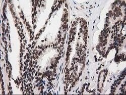 ATP6V1F Mouse anti-Human, Clone: OTI1B8, liquid, TrueMAB 100 &mu;L; Unconjugated:Antibodies,