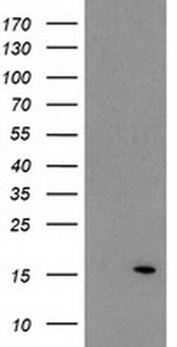 ATP6V1F Mouse anti-Human, Clone: OTI1B8, liquid, TrueMAB 100 &mu;L; Unconjugated:Antibodies,