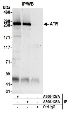 ATR Rabbit anti-Human, Polyclonal, Bethyl Laboratories 100 &mu;L; Unconjugated:Antibodies,