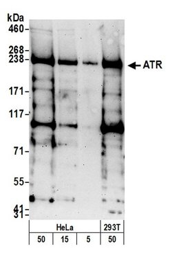 ATR Rabbit anti-Human, Polyclonal, Bethyl Laboratories 100 &mu;L; Unconjugated:Antibodies,