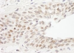 ATRIP Rabbit anti-Human, Polyclonal, Bethyl Laboratories 100 &mu;l; Unlabeled:Antibodies,