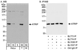 ATRIP Rabbit anti-Human, Polyclonal, Bethyl Laboratories 100 &mu;l; Unlabeled:Antibodies,