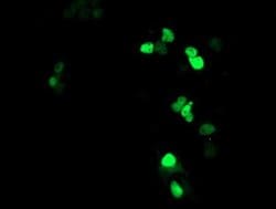 ATRIP Monoclonal Antibody (OTI4A8), TrueMAB , OriGene 100 &mu;L; Unconjugated:Antibodies,