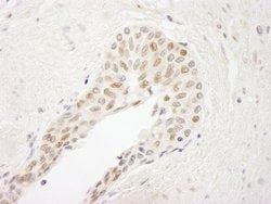 ATRIP Polyclonal Antibody, Bethyl Laboratories:Antibodies:Primary Antibodies
