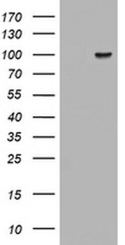 ATRIP Monoclonal Antibody (OTI1G6), TrueMAB , OriGene 100 &mu;L; Unconjugated:Antibodies,