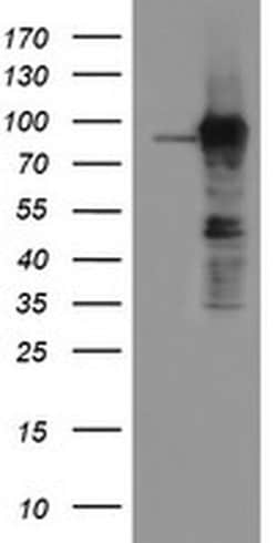 ATRIP Monoclonal Antibody (OTI4A8), TrueMAB , OriGene 100 &mu;L; Unconjugated:Antibodies,