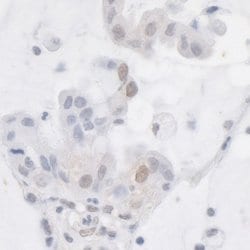 ATRX Rabbit anti-Human, Polyclonal, Bethyl Laboratories 100 &mu;L; Unconjugated:Antibodies,