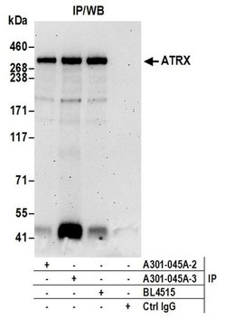 ATRX Rabbit anti-Human, Polyclonal, Bethyl Laboratories 100 &mu;L; Unconjugated:Antibodies,