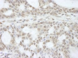 ATRX Polyclonal Antibody, Bethyl Laboratories 10 &mu;L | Buy Online | Bethyl Laboratories, Inc | Fisher Scientific