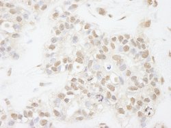 ATRX Polyclonal Antibody, Bethyl Laboratories 10 &mu;L | Buy Online | Bethyl Laboratories, Inc | Fisher Scientific