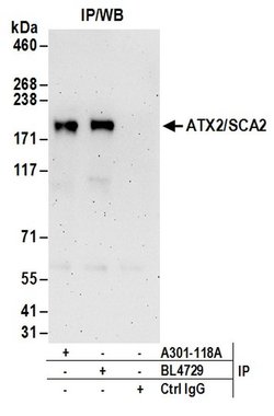ATX2/SCA2 Rabbit anti-Human, Mouse, Polyclonal, Bethyl Laboratories 100
