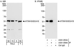 ATXN10/SCA10 Rabbit anti-Human, Polyclonal, Bethyl Laboratories 100 &mu;L;