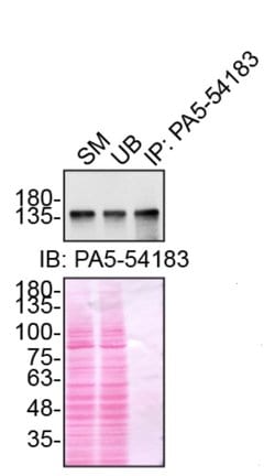 Invitrogen Ataxin 2 Polyclonal Antibody 100 &mu;L; Unconjugated:Antibodies,