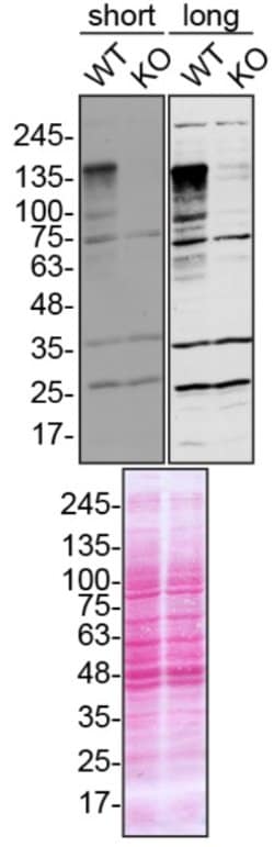 Invitrogen Ataxin 2 Polyclonal Antibody 100 &mu;L; Unconjugated:Antibodies,