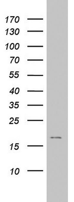 AVPI1 Monoclonal Antibody (OTI6C5), TrueMAB , OriGene 30 &mu;L; Unconjugated:Antibodies,