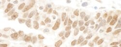 Abraxas Rabbit anti-Human, Polyclonal, Bethyl Laboratories 10 &mu;L; Unconjugated:Antibodies,