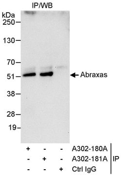 Abraxas Rabbit anti-Human, Polyclonal, Bethyl Laboratories 10 &mu;L; Unconjugated:Antibodies,