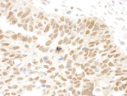 Abraxas Polyclonal Antibody, Bethyl Laboratories 10 &mu;L; Unconjugated:Antibodies,