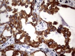 Acidic Cytokeratin Rat anti-Human, Clone: OTI8F5, liquid, TrueMAB 100 &mu;L;
