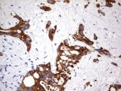 Acidic Cytokeratin Rat anti-Human, Clone: OTI8F5, liquid, TrueMAB 100 &mu;L;