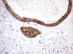 Acidic Cytokeratin Rat anti-Human, Clone: OTI8F5, liquid, TrueMAB 100 &mu;L;