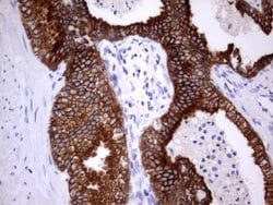 Acidic Cytokeratin Rat anti-Human, Clone: OTI8F5, liquid, TrueMAB 100 &mu;L;
