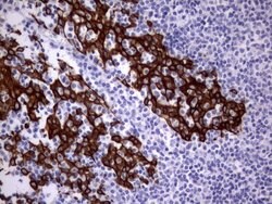 Acidic Cytokeratin Rat anti-Human, Clone: OTI8F5, liquid, TrueMAB 100 &mu;L;