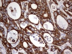 Acidic Cytokeratin Rat anti-Human, Clone: OTI8F5, liquid, TrueMAB 100 &mu;L;