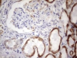 Acidic Cytokeratin Rat anti-Human, Clone: OTI8F5, liquid, TrueMAB 100 &mu;L;
