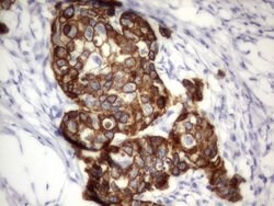 Acidic Cytokeratin Rat anti-Human, Clone: OTI8F5, liquid, TrueMAB 100 &mu;L;