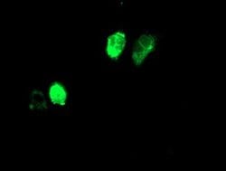 Adiponectin Mouse anti-Human, Clone: OTI1B2, liquid, TrueMAB 100 &mu;L;