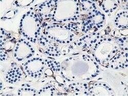 Adiponectin Mouse anti-Human, Clone: OTI1B2, liquid, TrueMAB 100 &mu;L;