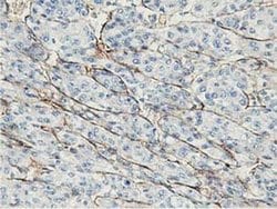 Adiponectin Mouse anti-Human, Clone: OTI1B2, liquid, TrueMAB 100 &mu;L;