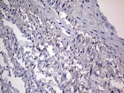 Adiponectin Monoclonal Antibody (OTI7H8), TrueMAB , OriGene:Antibodies:Primary