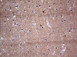Adiponectin Mouse anti-Human, Clone: OTI8A9, lyophilized, TrueMAB 100 &mu;g;