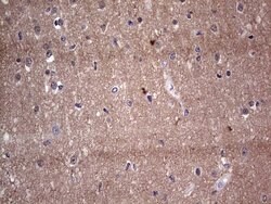 Adiponectin Monoclonal Antibody (OTI8A9), TrueMAB , OriGene 100 &mu;L;