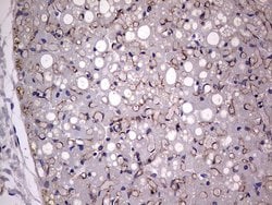 Adiponectin Monoclonal Antibody (OTI2E2), TrueMAB , OriGene 30 &mu;L; Unconjugated:Antibodies,