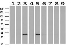 Adiponectin Mouse anti-Human, Clone: OTI1B2, liquid, TrueMAB 100 &mu;L;