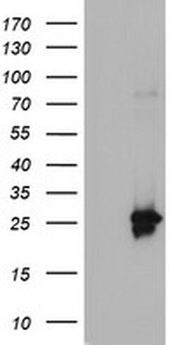 Adiponectin Monoclonal Antibody (OTI7B11), TrueMAB , OriGene 100 &mu;L;