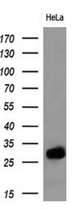 Adiponectin Monoclonal Antibody (OTI7B11), TrueMAB , OriGene 100 &mu;L;