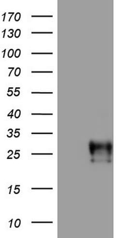 Adiponectin Monoclonal Antibody (OTI1A8), TrueMAB , OriGene:Antibodies:Primary