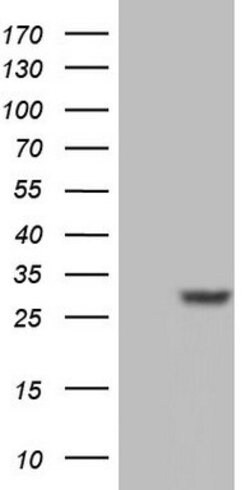 Adiponectin Mouse anti-Human, Clone: OTI2C9, lyophilized, TrueMAB 100 &mu;g;