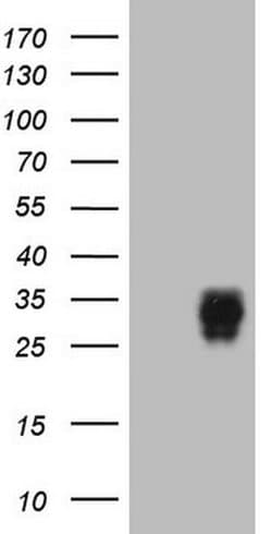 Adiponectin Monoclonal Antibody (OTI2G8), TrueMAB , OriGene 30 &mu;L; Unconjugated:Antibodies,