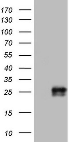 Adiponectin Monoclonal Antibody (OTI8A9), TrueMAB , OriGene 100 &mu;L;