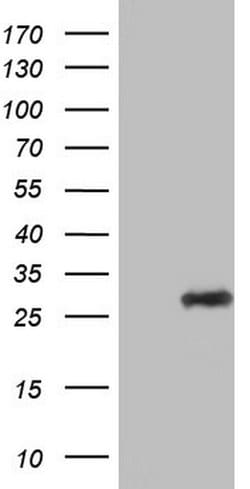 Adiponectin Monoclonal Antibody (OTI2E2), TrueMAB , OriGene 30 &mu;L; Unconjugated:Antibodies,