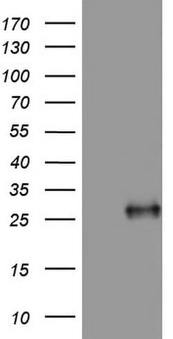 Adiponectin Mouse anti-Human, Clone: OTI8F9, lyophilized, TrueMAB 100 &mu;g;